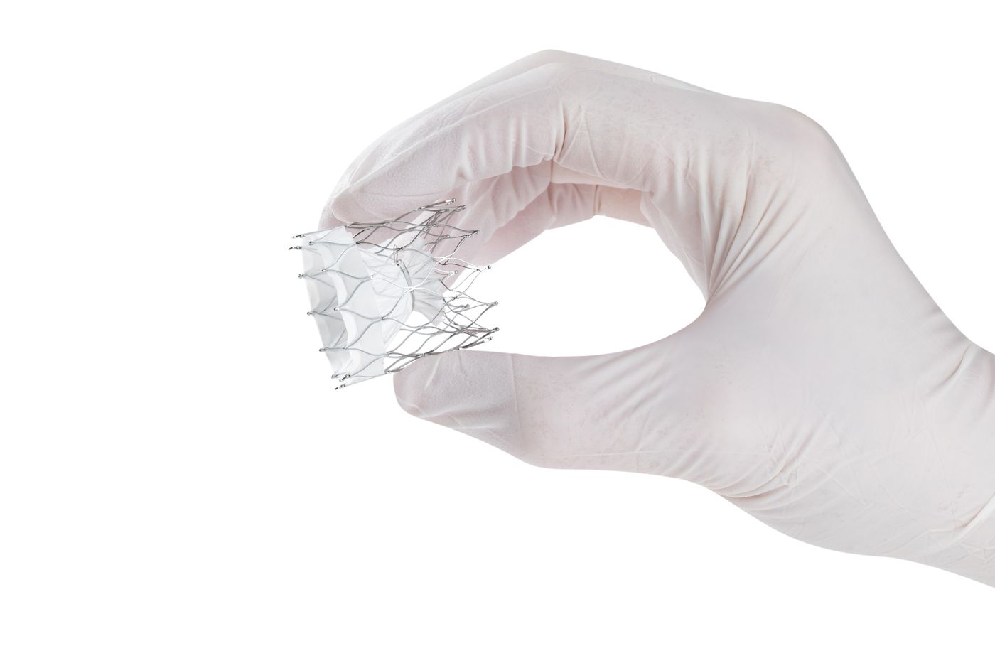 Side view of the UPright implant